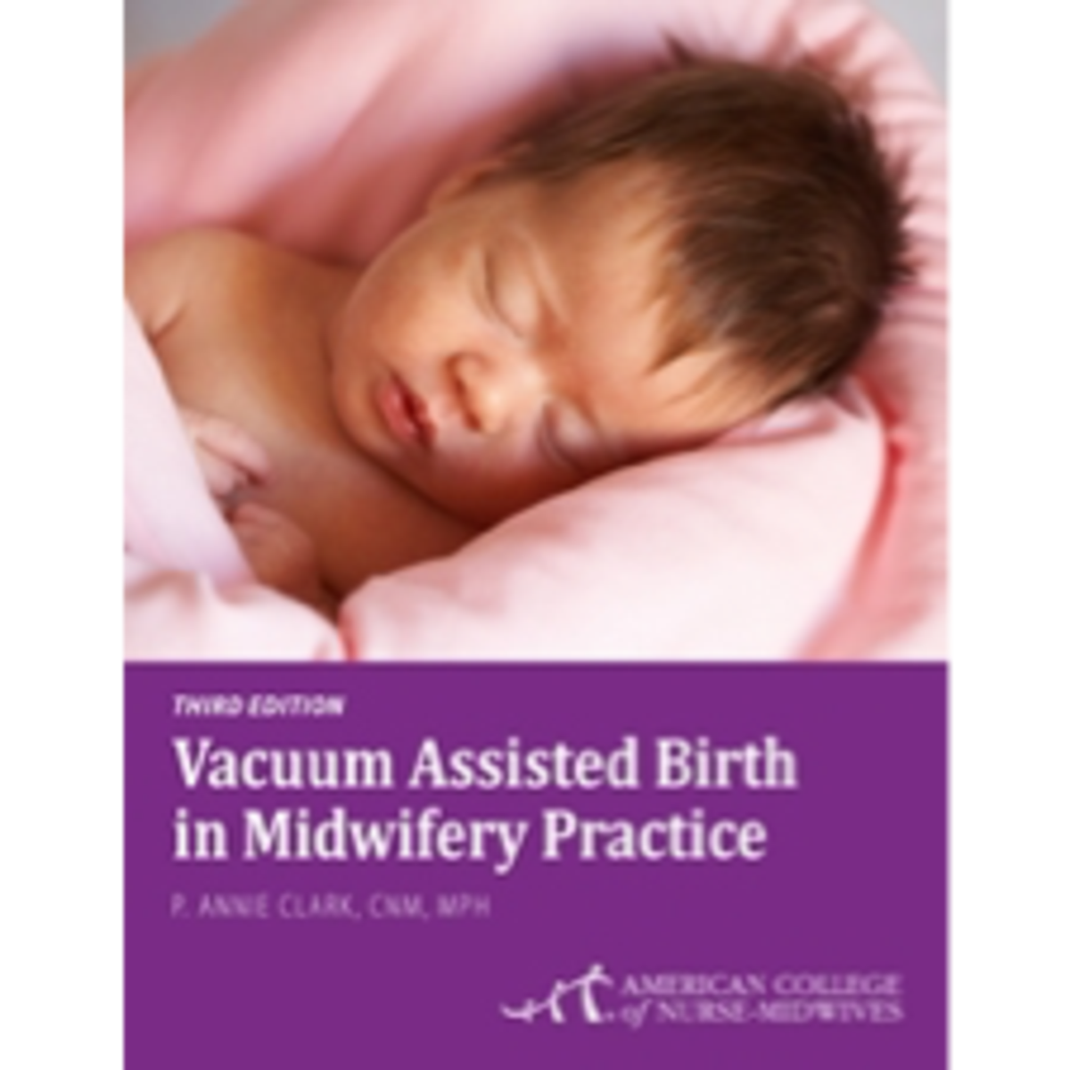 Vacuum Assisted Birth in Midwifery Practice DIGITAL